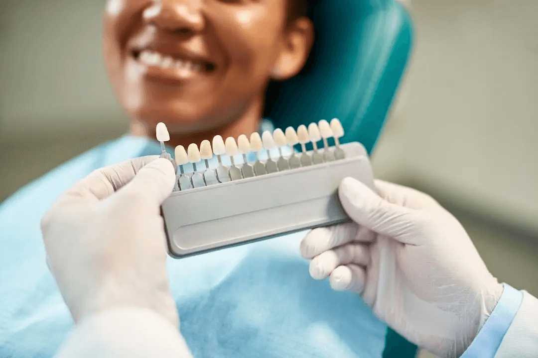 Dentist matching a porcelain veneer shade guide to a smiling patient’s teeth