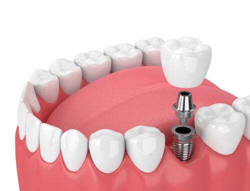 The Silent Threat: Why Gum Disease Should Never Be Ignored